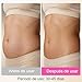 Imagen de Zrwuldu Radiofrecuencia Facial y Corporal 3 en 1
