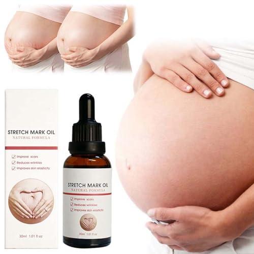 Reinigungsöl gegen Dehnungsstreifen, glättendes Feuchtigkeitsöl gegen, glatte Haut, Lösung gegen Dehnungsstreifen, 30 ml PZs451 (White, 3x10.1)