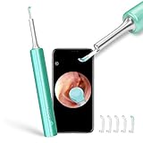 otoskop heine 👂【Easy to Use】 Unser Otoskop-Ohrenschmalzentferner-Reiniger hat ein Drei-Achsen-Gyroskop, was bedeutet, dass Sie eine stabile Bildübertragung in jedem Winkel erhalten können. Scannen Sie einfach den QR-Code, um die APP herunterzuladen, schalten Sie das Gerät ein, verbinden Sie das Produkt mit dem eingebauten Wifi, jetzt können Sie beginnen, es zu benutzen.