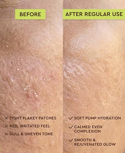 Image of R.O.A Skincare Aqua centella dry skin face wash for glowing hydrated skin