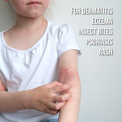 Image of Quitch Hydrocortisone Healing Balm, Eczema Cream For Kids, Psoriasis Relief Treatment, Anti Itch Maximum Strength, Healing Ointment, Rash, Dry Skin Treatment for Skin, Avocado Oil Squalane