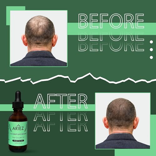 Ariez Coconut & Rosemary Oil Hair Growth Serum - Promotes Thicker and Fuller Looking Hair - For Dry & Damaged Hair - Anti Frizz- Stimulate Follicles, Promote Regrowth - Cruelty Free - 55ml - Image 5