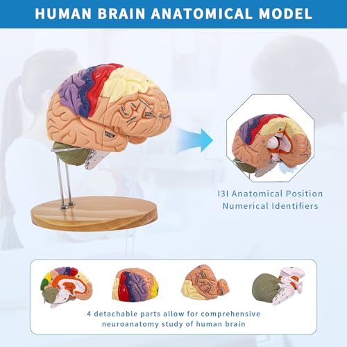 Image of Brain Model 3D, 2 Times Enlargement 4-Part Human Brain Model with Functional Area Color Separation and Anatomical Location Identification for Learning the Structure of the Brain
