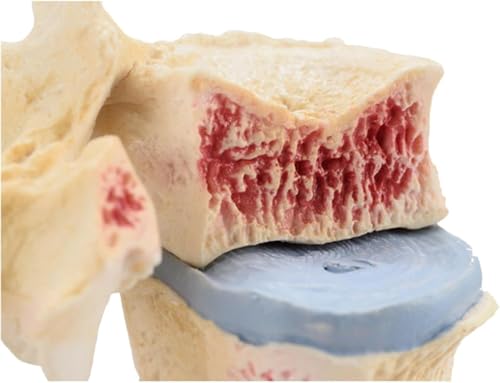 Modèle d'ostéoporose vertèbre humaine matériel médical - 2