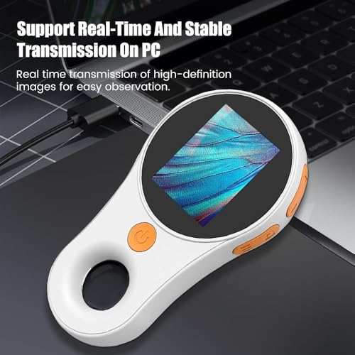 Image of Handheld Dermatoscope Skin Analyzer Machine, Wireless Portable Digital Microscope with 1080P IPS Screen 8 LEDs, 500X Magnifier, for Scalp /Hair Trichomes Facial Skin Dermatoscope