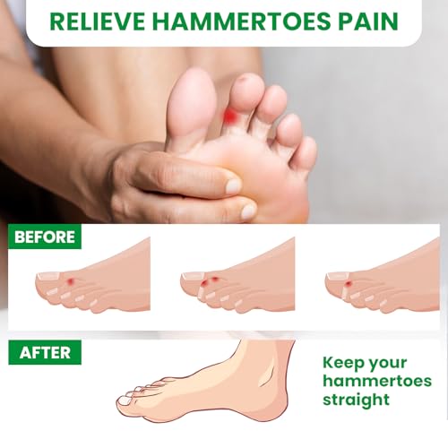 Bukihome Hammertoe Corrector - 6 Count Gel Toe Straighteners and 1 Count Broken Toe Wrap - Realign Bent, Curled, Crooked, Claw, Hammer Toes - Toe Corrector Splints for Men and Women, 4 Different Sizes