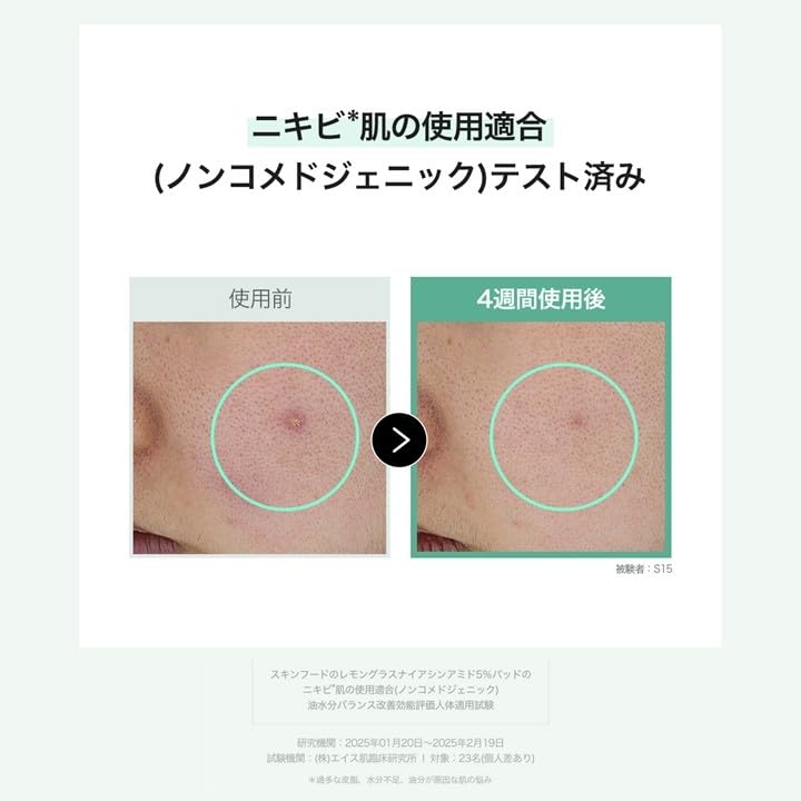 Amazon | SKINFOOD(スキンフード) レモングラスナイアシンアミド5