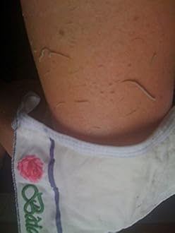 Baiden Exfoliator System-Best Firming Face Body & Back Scrub Mitts-Remove Blackheads Dry Skin Wrinkles Cellulite Controls Acne-Top Facial Lips Eyelids Treatment-Circulation and Collagen Boosting