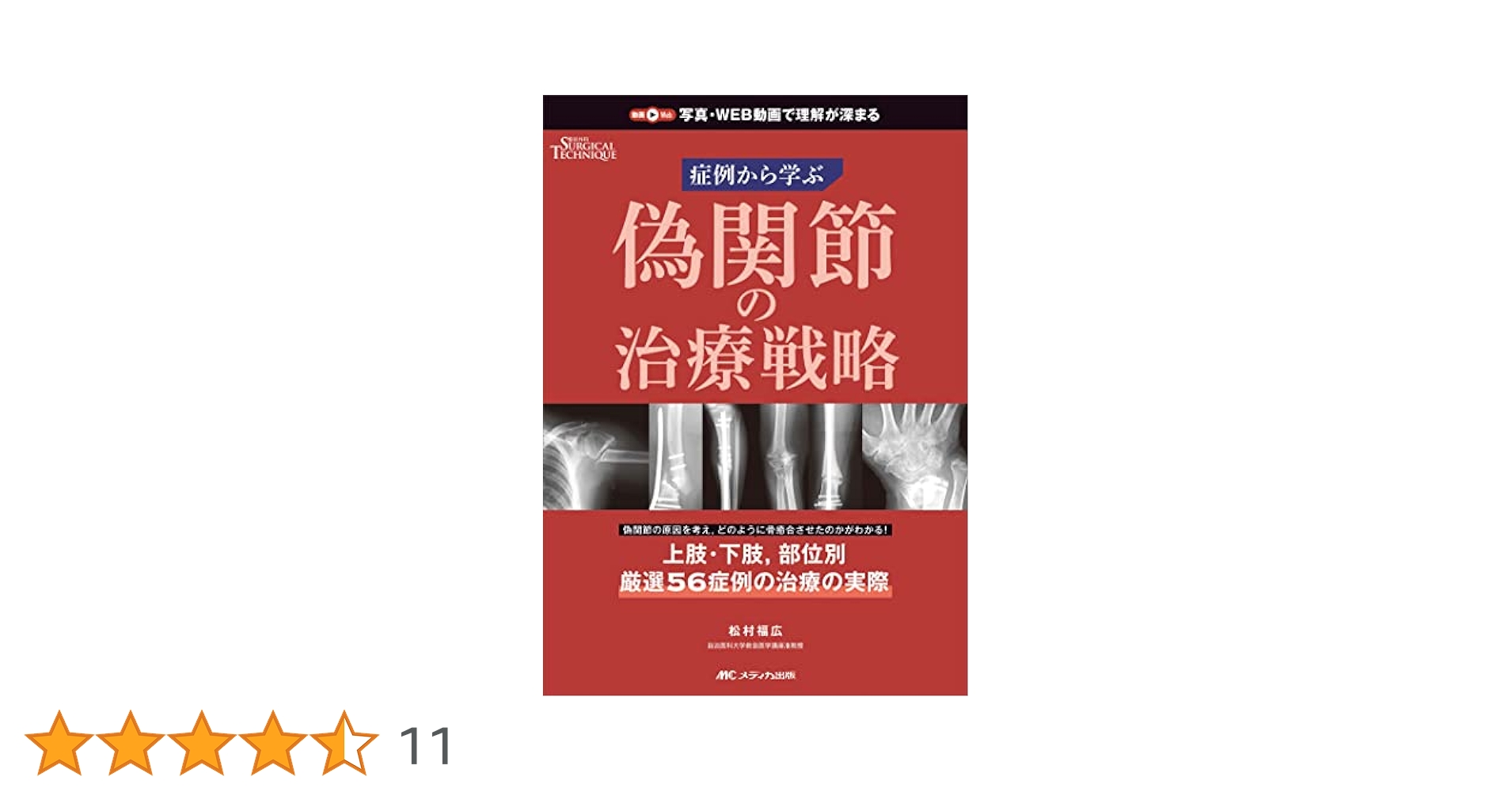 偽関節の治療戦略 偽関節の治療戦略: 症例から学ぶ (整形外科サージカルテクニック