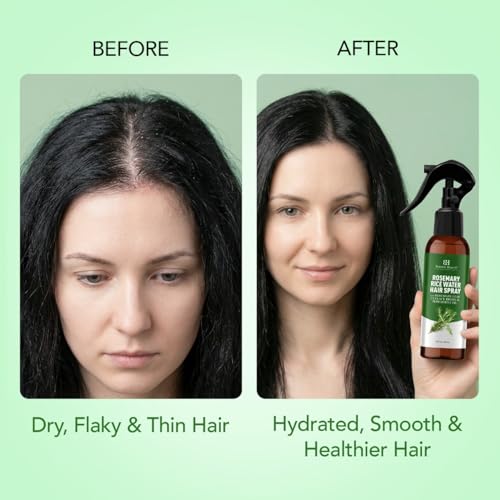 Botanic Hearth Rosemary Rice Water Spray for Hair Growth 200ml | Strengthen & Moisturize | Natural Scalp Care for Thicker, Healthier Hair | Ideal Leave-In Conditioner Alternative for All Hair Types| For Men and Women