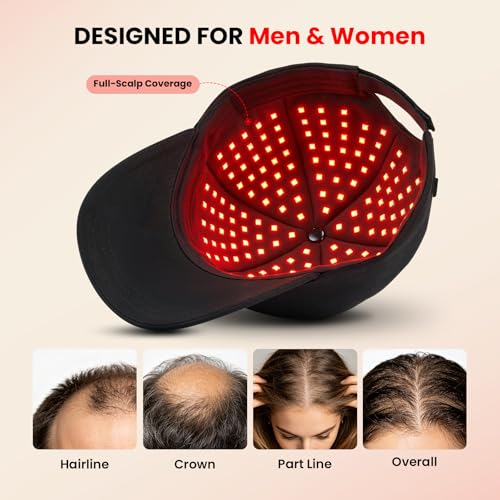 Image of CAYAMA Red Light Hair Growth Cap for Men & Women, 528 Total Light Emitters | Full-scalp coverage with adjustable fit, 10-30 min remote sessions, adapter or compatible power bank support