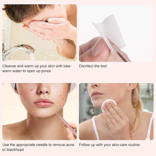 Pickel Ausdrücken Werkzeug,Pickelentferner,Mitesserentferner,Komedonenquetscher,Gesichtsreinigungs- und… - Image 3