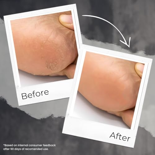 TRU HAIR & SKIN Foot Butter With Free Foot Scrubber | For Cracked Heels | 50gm