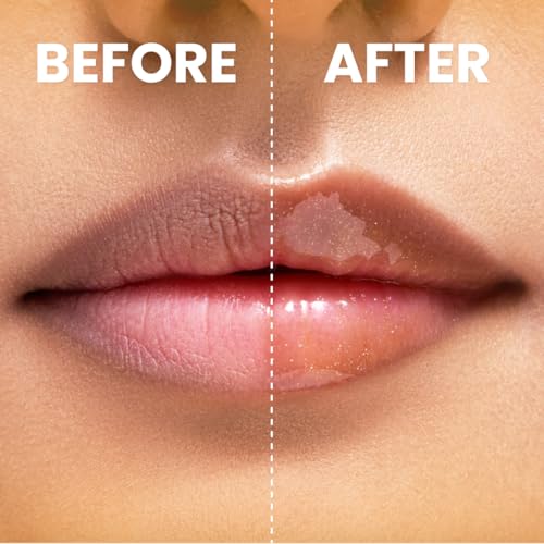 Image of Typsy Beauty Hi Honey! SPF 25 Lip Oil| 7ml|Gloss like shine Enriched with Mirsalehi Honey & Vitamin E,PA+++ High UVA Protection |Zero Taste| Protects chapped lips with Metal Cooling Applicator