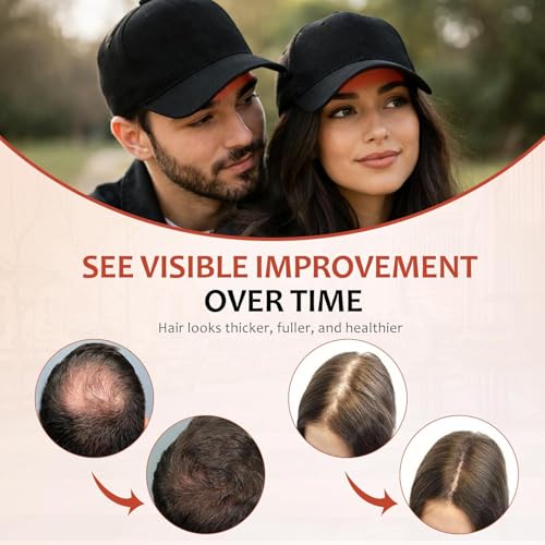 Image of Laser Hair Growth Cap - 650nm Red Light Therapy for Hair Regrowth, Full Scalp Coverage Treatment for Men & Women with Thinning Hair, Portable & Hands-Free, Black