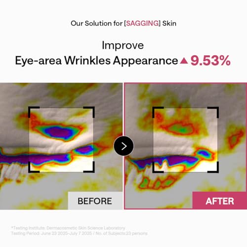 Image of MEDIHEAL Retinol Capsule Eye Patches - Korean Hydrogel Under Eye Patch for Fine Lines, Wrinkles & Firming- Full Coverage(70mm Wide) - Non Irritating, Encapsulated Retinol, 60 Count
