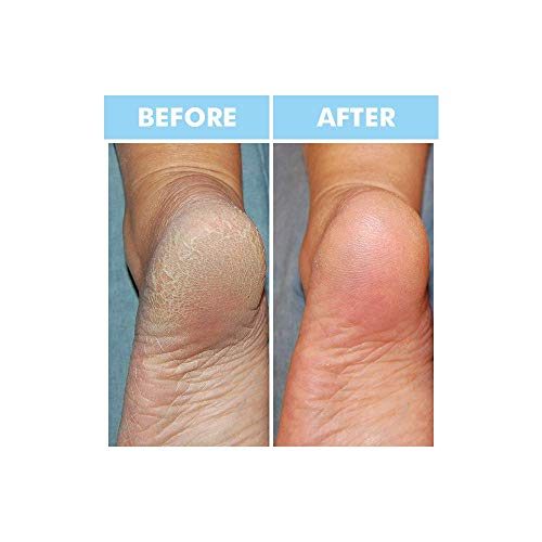 Bodipure 4 Packs Keratin Socks Double Value For Nourishing, Softening And Repairing Dry Feet – Moisturizing Socks Therapy For Dry, Cracked Feet, Softening Callus For Women Men (8 Foot Socks Pairs) #TOP4