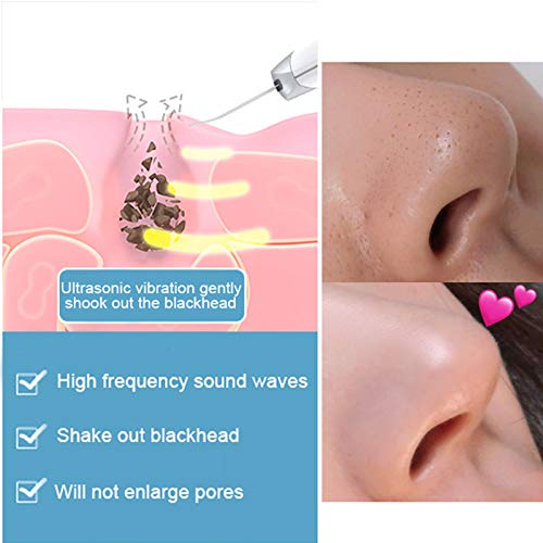 Scrubber per la Pelle del Viso, Pulizia del Viso