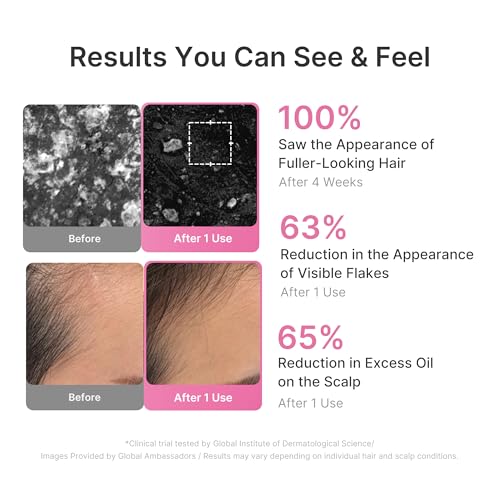 Image of medicube Rosemary PDRN Clarifying Thickening Shampoo | Cooling, Clarifying Care for Thinning, Weak & Flaky Hair | Amino Acid Complex for Stronger, Thicker-Looking Hair | Korean Hair Care, 13.52 fl.oz
