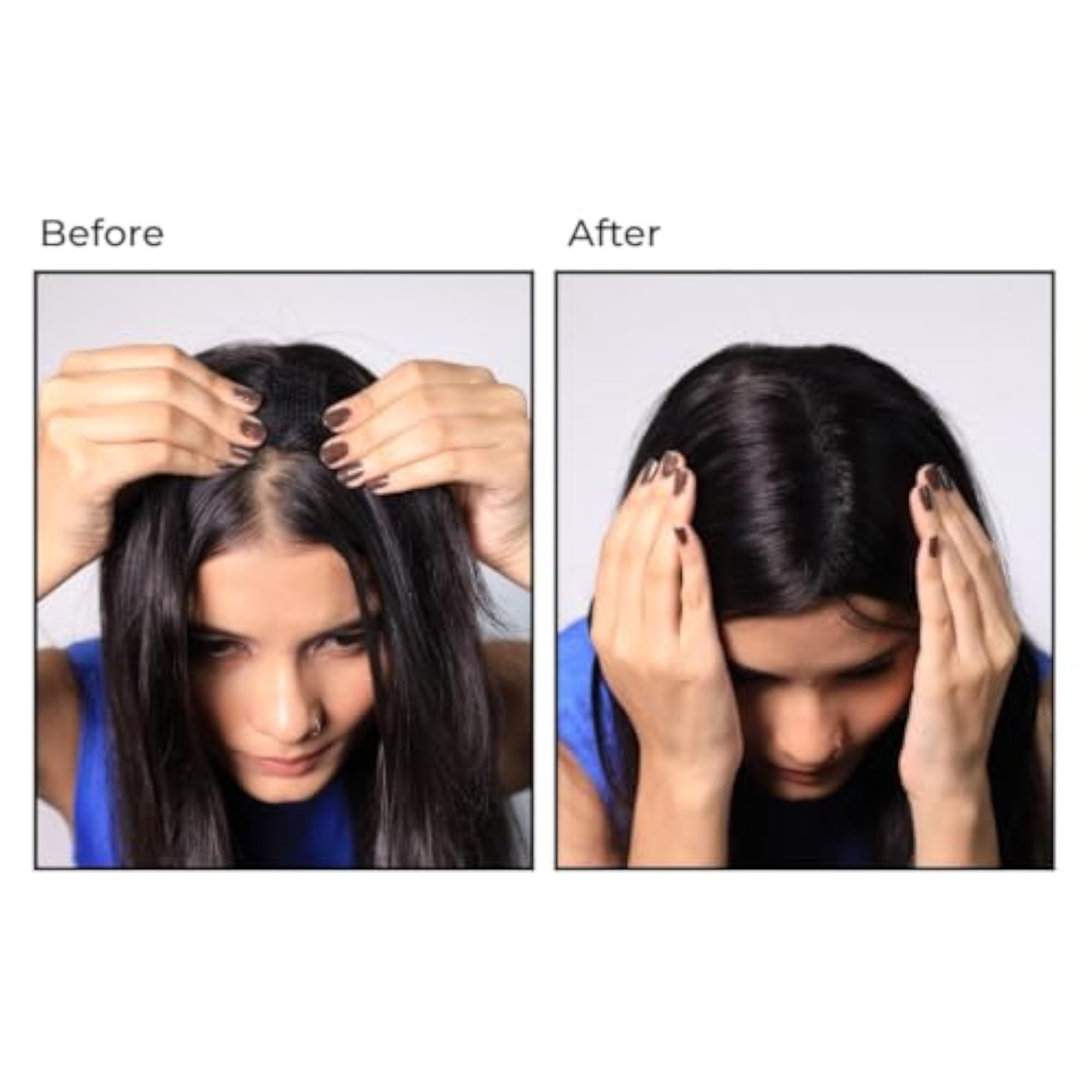Hairarchy Magic Topper for Women, Clipless Scalp Coverage Solution