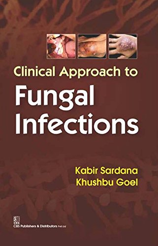 Buy Clinical Approach to Fungal Infections Book Online at Low Prices in ...