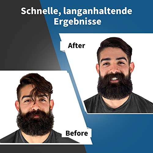 Foto von Bartglätter Kamm für Männer, 2 in 1 Ionischer Bartbürste Haarglätter, 170 ℃ -210 ℃ Temperatur Einstellbar, 30s Schnelle Erwärmung Verbrühungsschutz 30W, Glätten Glätter für Haar und Bart Glätteisen