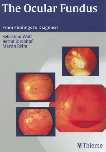 Buy The Ocular Fundus: From Findings to Diagnosis — BookShops.in