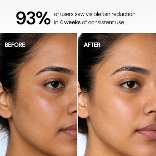 Image of Clarity Labs | DETAN BRIGHTENING SOAP | (Pack of 4) | Tan Removal | KOJIC ACID SOAP | Niacinamide | Vitamin C Kojic | Dark Spot Removal | Even Skin Tone | Glowing Brighter Skin | Reduces underarm pigmentation