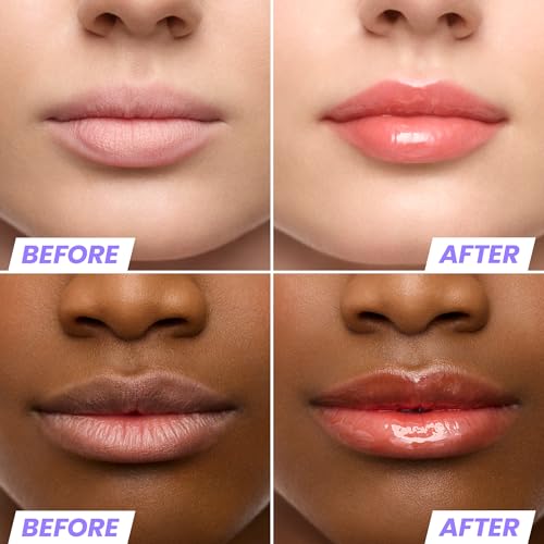Image of Wonderskin Lip Oil Rehab Serum - Tinted Lip Oil, Hydrating Lip Serum