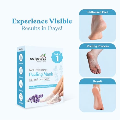 Image of Wipness Natural Foot Peeling & Exfoliating Foot Mask for Baby Soft Feet | Removes Dead Skin & Calluses | Hydrates & Smooths Cracked Heels - Pack of 1