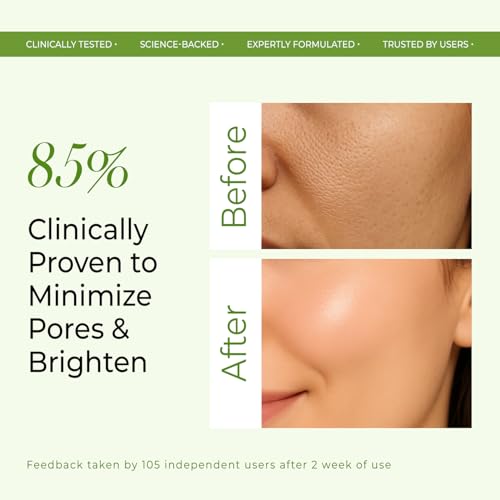 Image of VINR 10% Niacinamide & 1% Hylauronic Acid Rice Water Face Toner Pore Tightening & Glowing Skin Oil Control | Hydrating Facial Toner for Acne-Prone, Sensitive & All Skin Types | Women & Men -300ml (Pack of 3 )