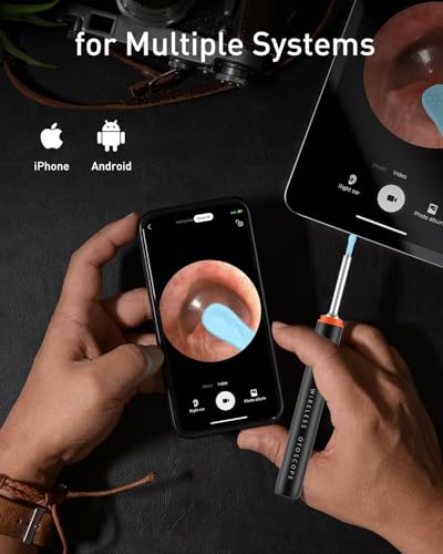 Image of Yorsfun Ear Wax Removal, 3 in 1 Earwax Removal Kit, 1080P HD Ear Cleaner with Camera, FSA HSA Eligible, Otoscope with 7 Ear Spoon, Ear Cleaning 6 LED Lights 6 Ear Tips, Ear Camera for iOS & Android