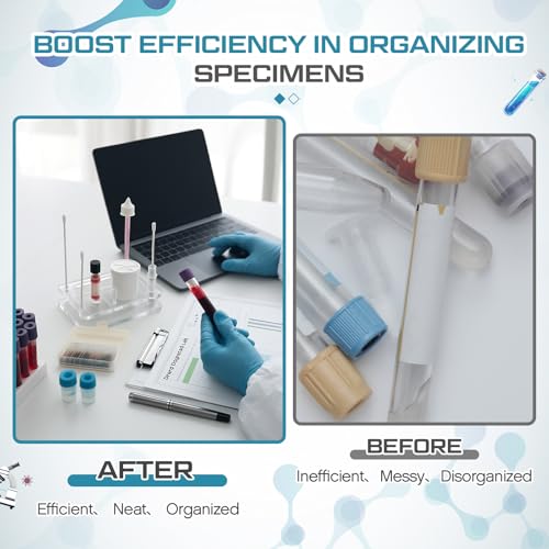 Image of Thyle 2 Pcs Pap Smear Specimen Organizer Tray, 5.8 x 3.6 x 1.5 Inch