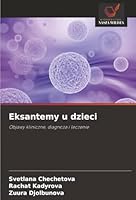 Eksantemy u dzieci: Objawy kliniczne, diagnoza i leczenie (Polish Edition) 6203892084 Book Cover