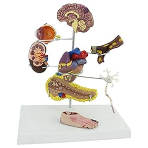 Het Model Van Het Diabetesorgaan Pvc Menselijke Anatomie Complicatie Cerebrale Hartpancrea Neuron Chirurgie, Opleidingshulp