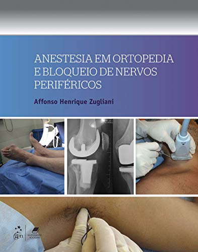 Anestesia em Ortopedia e Bloqueio de Nervos Periféricos