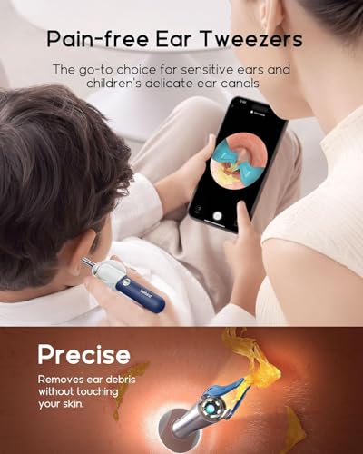 Image of Earsight Plus R37R Ear Cleaning Camera Wax Removal Tool kit, Flexible Ear Scope Otoscope Camera Light, Visual Ear Picker Wireless Earwax Remover Tweezers for Adults & Kids (Premium Ear Wax)