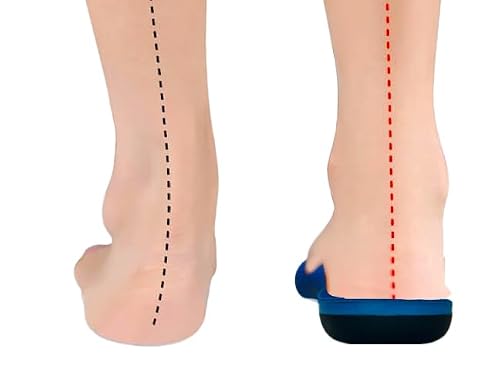 Podotech® Fasciafix Plantar Fasciitis Insoles - Heel Pain Relief And Control For Flat Feet Also Help With Supination - Arch Support For Men And Women - Recommended By Physios - 5