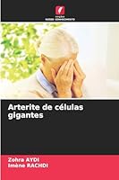 Arterite de células gigantes 6209261280 Book Cover
