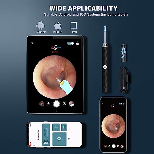 Ear Wax Removal Tool Camera, (1296P) Ear Cleaner With Light And Camera Ear Wax Cleaner With 8Pcs Ear Set, Earwax Removal Kit Compatible With Iphones, Ipad, Android Phones #TOP4