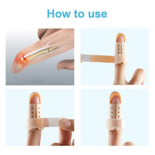 List 91+ Pictures How To Splint A Pinky Finger At Home Superb