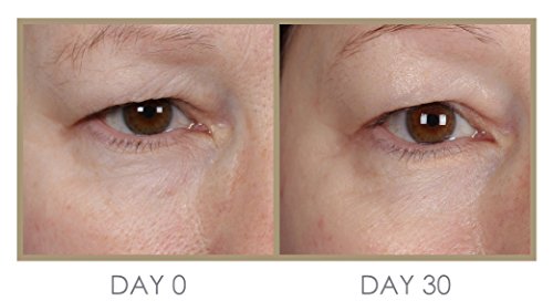 Genie H'eye'drator Plus Eye Cream #TOP1