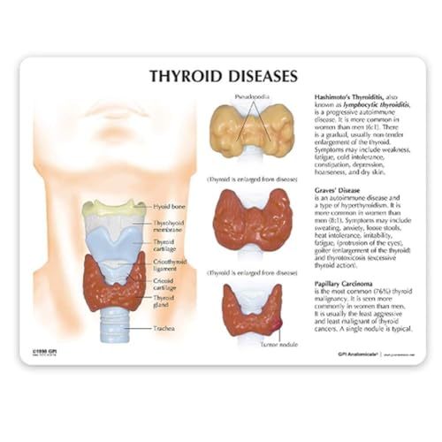 Modèle de thyroïde et réplique anatomique humaine pour cabinet médical