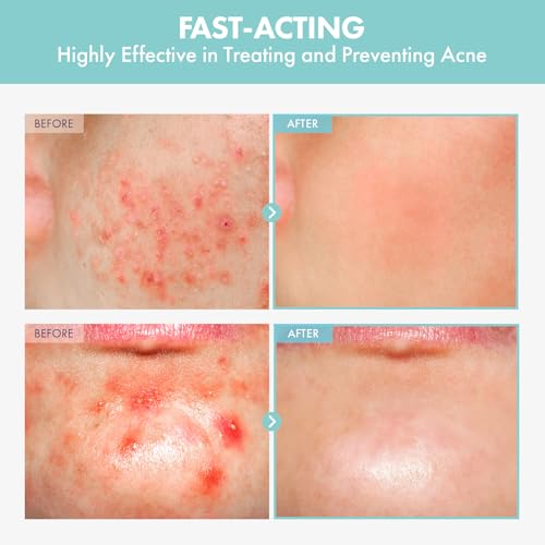 NATUREKIND Heartleaf Tea Tree Tok, Soothing Toner Serum, Centella Asiatica, Korean Facial Skincare for Pore Control, Calming, Nourishing. 50ml, 1.69 fl. oz. - Image 3