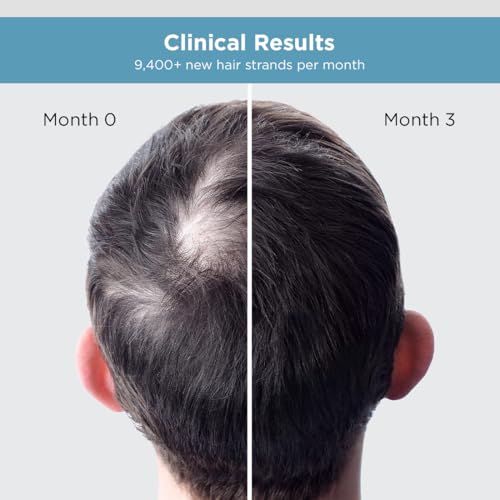 Image of The Man Company Hair Growth Serum for Man (30ml) with 3% Redensyl, 4% Anagain, 3% Biacapil | Stimulates Hair Growth | Prevents Hair Fall | Improves Hair Strength