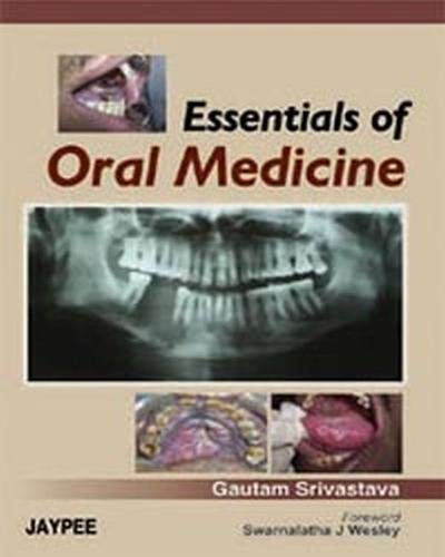 Buy Essentials of Oral Medicine Book Online at Low Prices in India ...