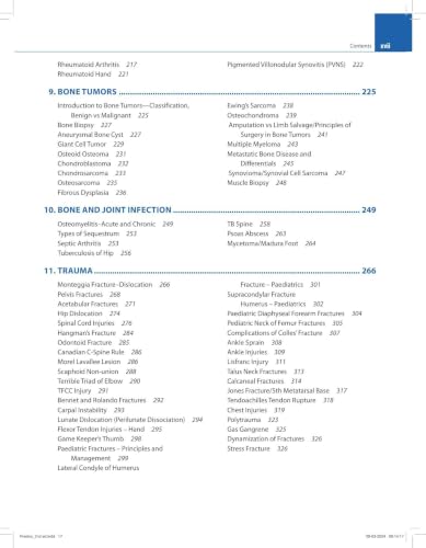 Image of Orthopedic Exam Review, 2 /E for MS, DNB & Diploma Orthopedic Postgraduates | 300+ PG Exam Questions with Hand-Drawn Flowcharts, Tables & Diagrams for ... A Comprehensive Manual for Postgraduates: 1