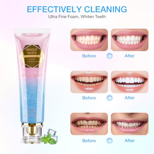 Image of Niacinamide Whitening Toothpaste, Radiant Niacinamide Toothpaste with Mint Flavor - Natural Gentle Care, Deep Stain Removal Clean, Fluoride-Free Whiten Toothpastes Improves Gum Health