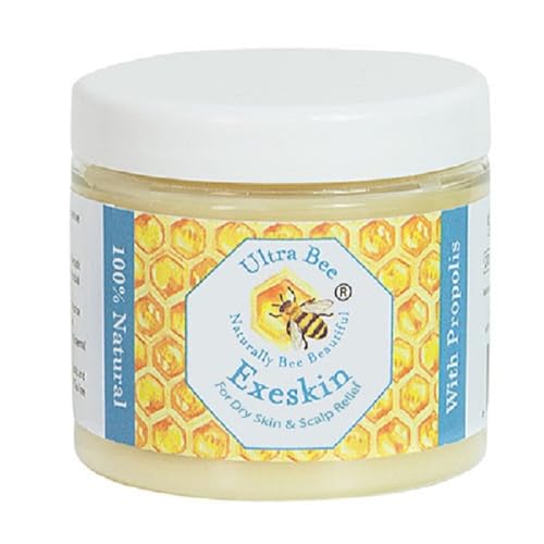 100% Natural Exeskin Balm 200ml - Dry Sensitive Skin and Dry Itchy Scalp - Also Suitable for People Prone to Eczema Psoriasis Dermatitis Rosacea