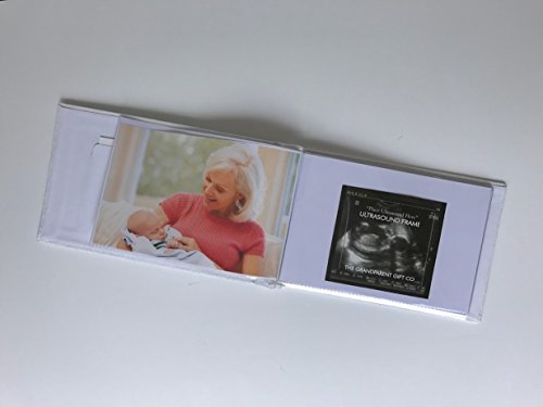 Pregnancy/Maternity Ultrasound And Photo Album/Keepsake - Thumbnail 6